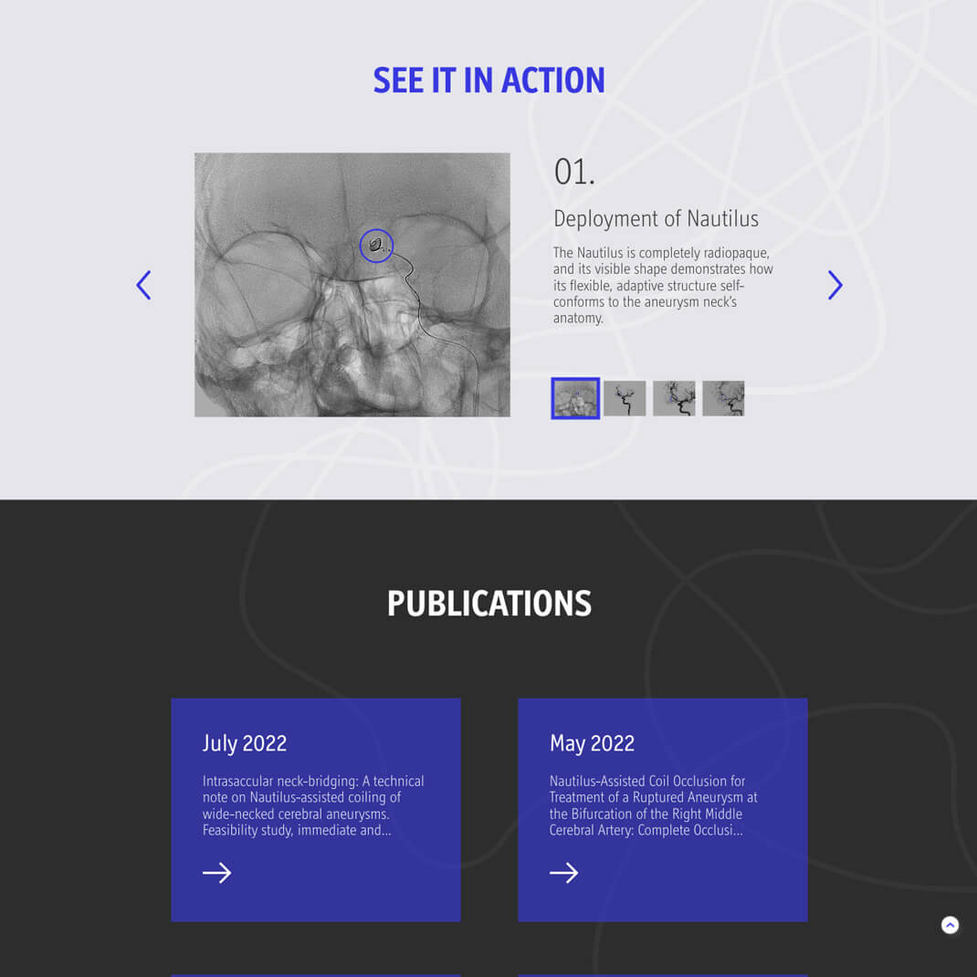 EndoStream — project view 3