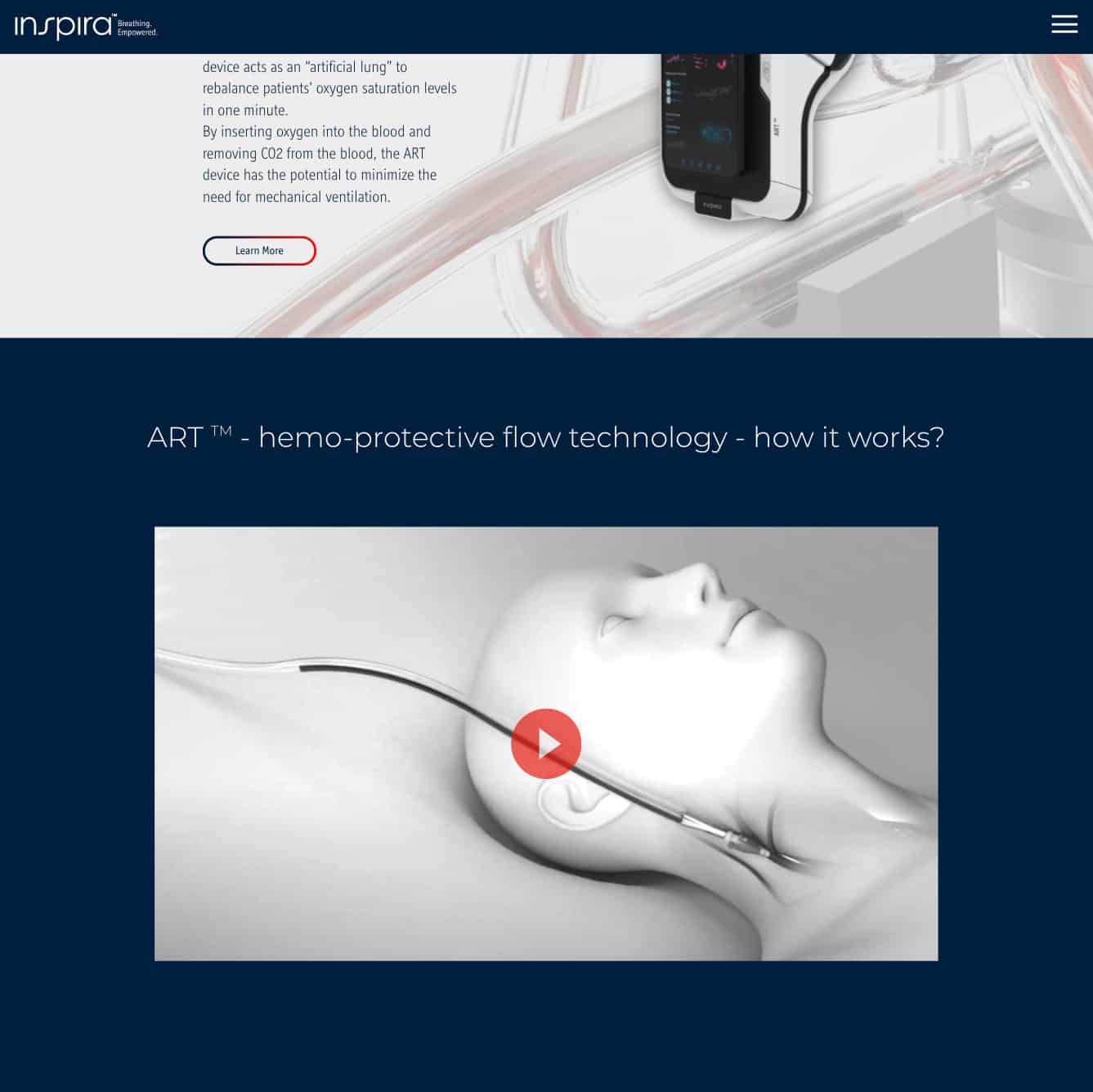 Inspira Technologies — project view 1