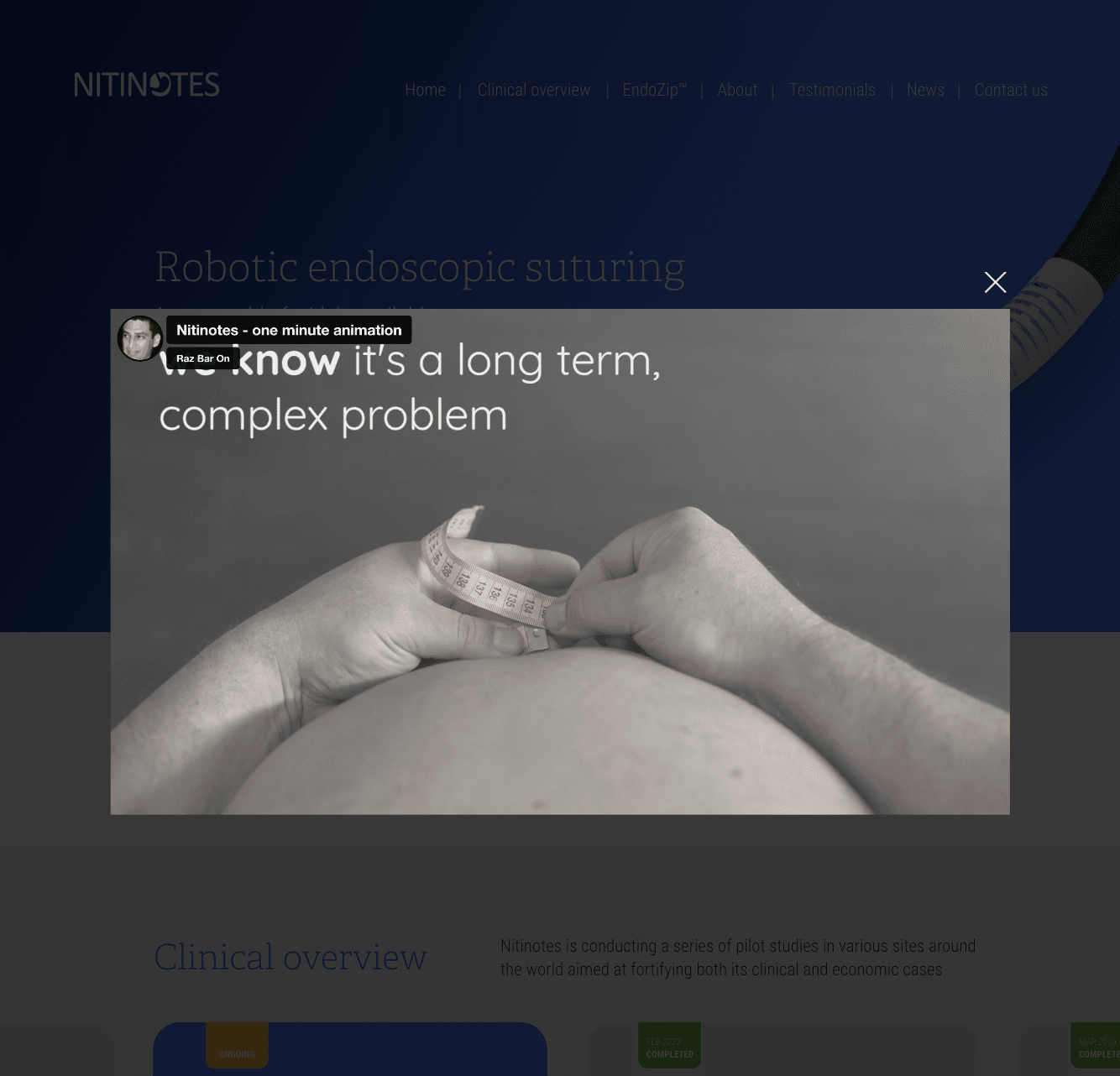 Nitinotes — project view 1